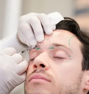 A male patient receiving Botox in the upper face.