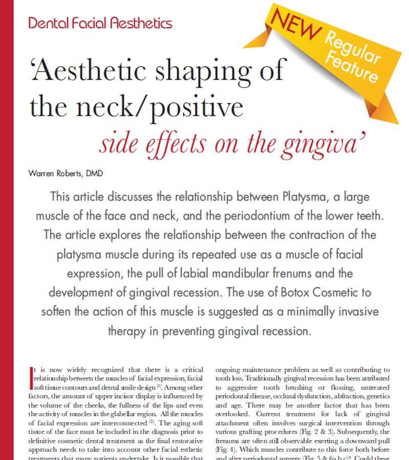 Aesthetic shaping of the neck/positive side effects on the gingiva.