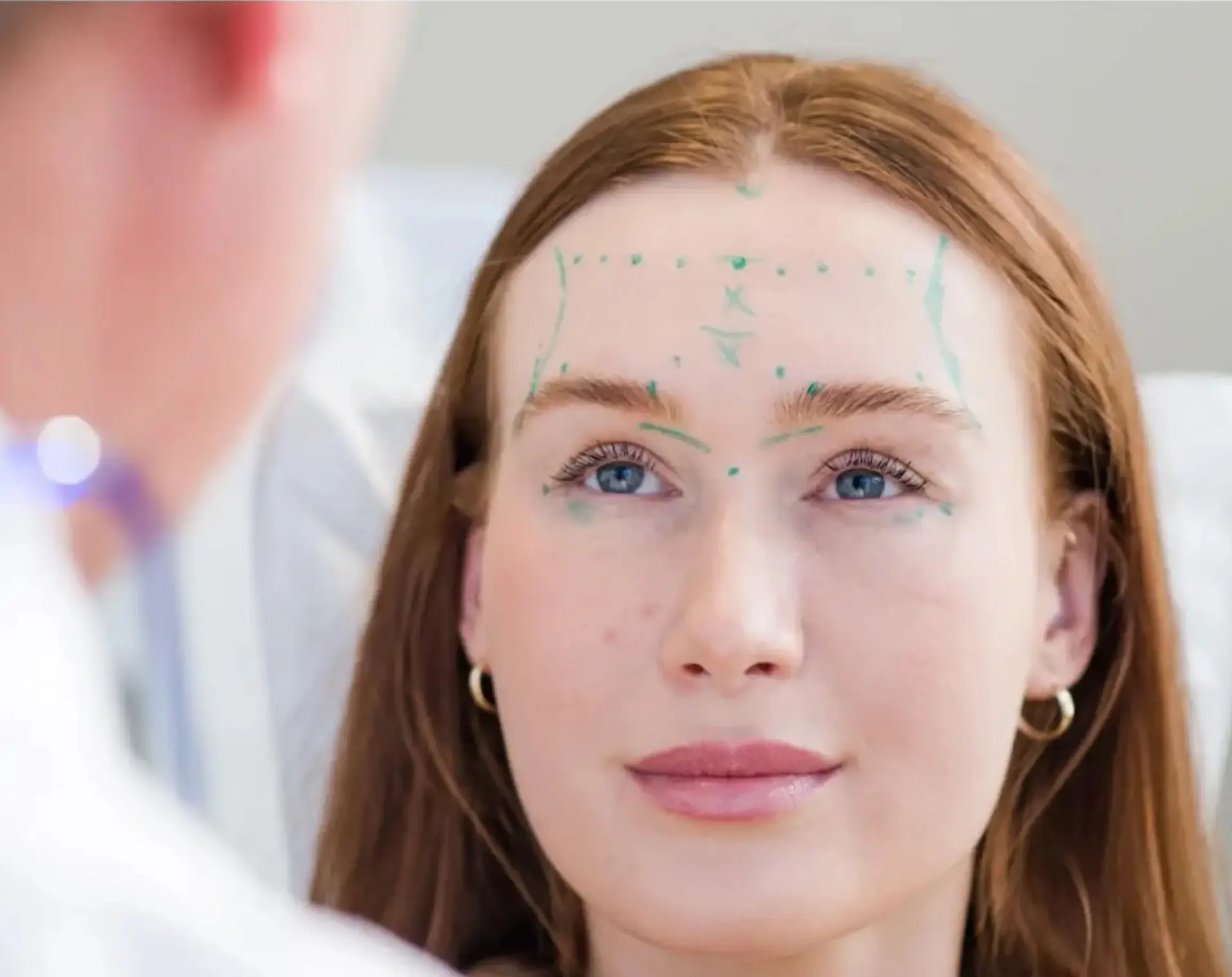 Reconstituting-Botox