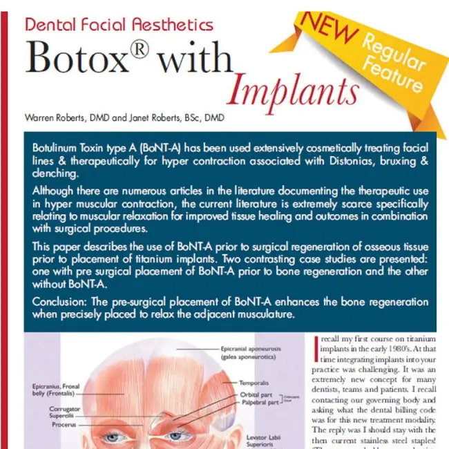 Botox with Implants article.