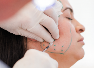 Therapeutic masseter Botox on a dental patient.