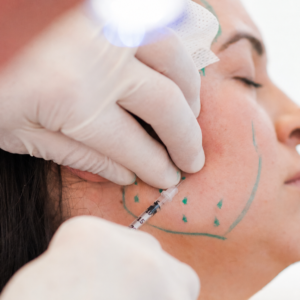 Botox thérapeutique du masséter chez un patient dentaire.