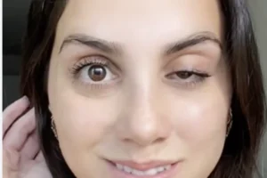 Webinar: Botox Complications – Prevention, Recognition & Management